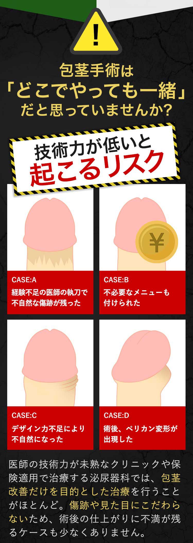 包茎手術は「どこでやっても一緒」だと思っていませんか?