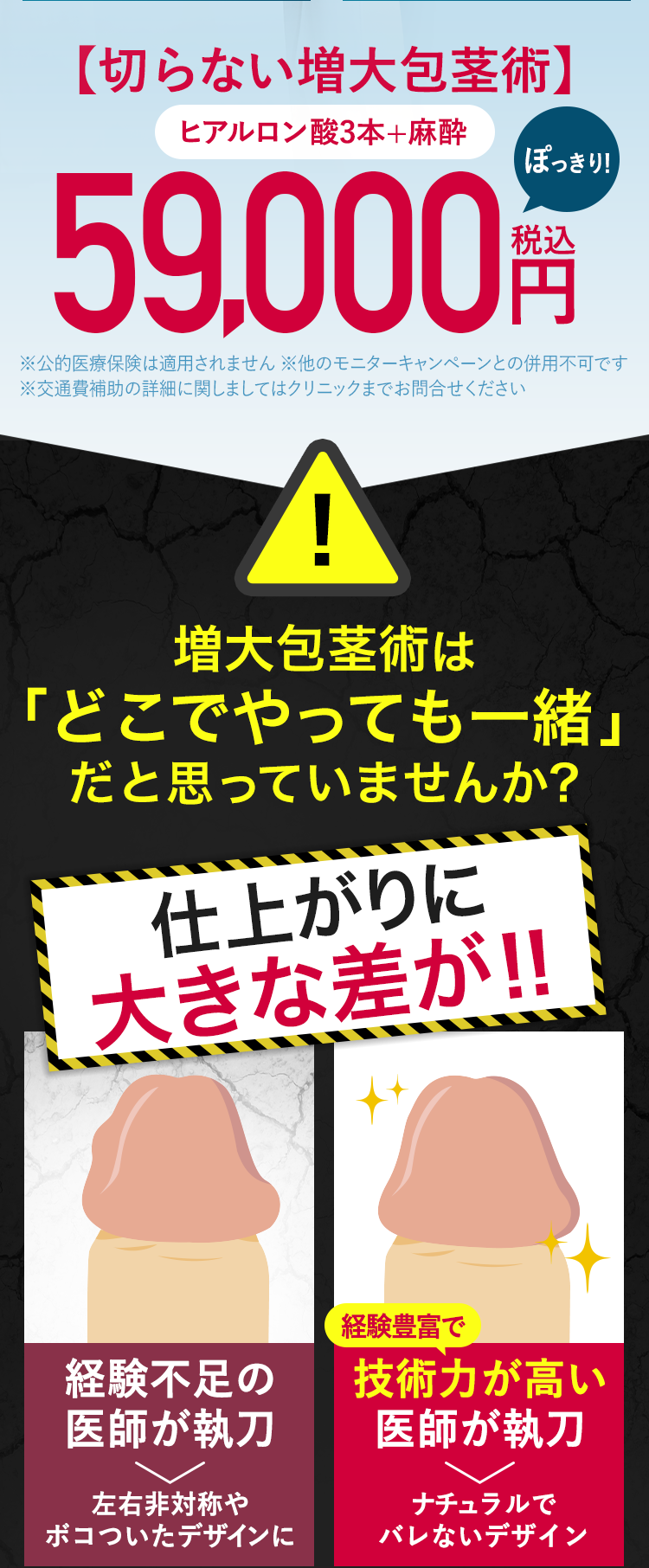 増大包茎術は「どこでやっても一緒」だと思っていませんか？