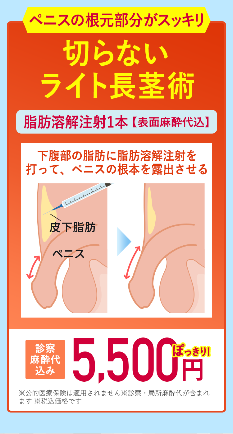 切らないライト長茎術