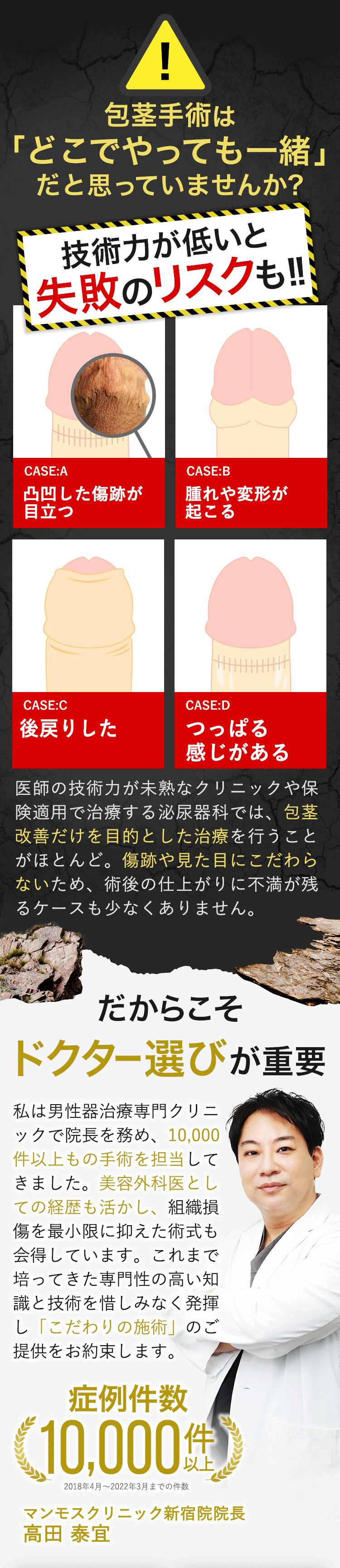 包茎治療は「どこでやっても一緒」だと思っていませんか？技術力が無いと失敗のリスクも｜だからこそドクター選びが重要