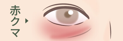 赤クマ
