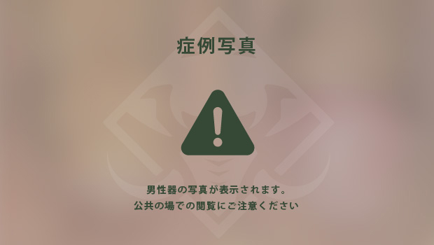 症例写真