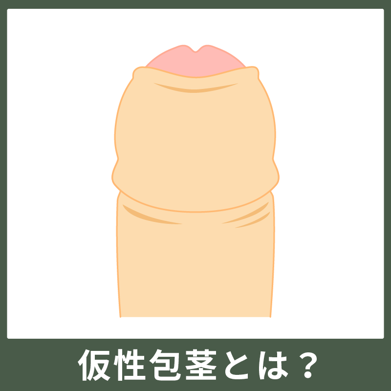 仮性包茎のイメージ